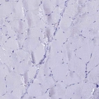 Immunohistochemical staining of human skeletal muscle shows low expression as expected.