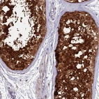 Immunohistochemical staining of human testis shows high expression.