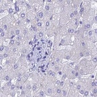 Anti-LZTFL1 Antibody