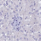 Immunohistochemical staining of human liver using Anti-LZTFL1 antibody HPA043466.