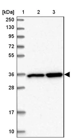 Lane 1: Marker [kDa] 250, 130, 95, 72, 55, 36, 28, 17, 10_br/_Lane 2: Human cell line RT-4_br/_Lane 3: Human cell line U-251MG sp