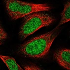 Immunofluorescent staining of human cell line U-2 OS shows localization to nucleoplasm.