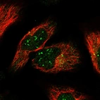 Immunofluorescent staining of human cell line U-2 OS shows localization to nucleoli fibrillar center & vesicles.