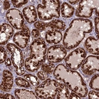 Immunohistochemical staining of human kidney shows strong cytoplasmic granular/cytoplasmic membranous positivity in cells in tubules.
