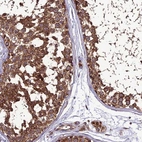 Immunohistochemical staining of human testis shows strong cytoplasmic granular/cytoplasmic membranous positivity in cells in seminiferous ducts.