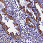 Immunohistochemical staining of human endometrium shows strong granular cytoplasmic positivity in glandular cells.