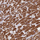 Immunohistochemical staining of human heart muscle shows strong granular cytoplasmic positivity in cardiomyocytes.