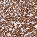 Immunohistochemical staining of human heart muscle shows strong granular cytoplasmic positivity in cardiomyocytes.