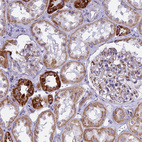 Immunohistochemical staining of human kidney shows strong granular cytoplasmic positivity in cells in tubules.