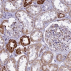 Immunohistochemical staining of human kidney shows strong granular cytoplasmic positivity in cells in tubules.
