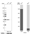 Western blot analysis in human cell lines PC-3 and HeLa using Anti-VDAC2 antibody. Corresponding VDAC2 RNA-seq data are presented for the same cell lines. Loading control: Anti-HSP90B1.