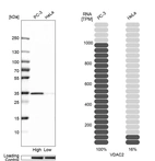 Western blot analysis in human cell lines PC-3 and HeLa using Anti-VDAC2 antibody. Corresponding VDAC2 RNA-seq data are presented for the same cell lines. Loading control: Anti-HSP90B1.