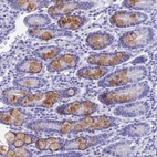 Anti-KDELR3 Antibody