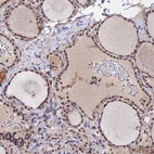 Immunohistochemical staining of human thyroid gland shows high expression.