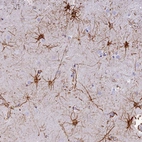 Anti-C17orf67 Antibody