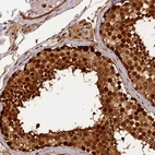 Anti-MICALL1 Antibody