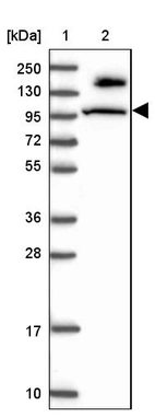 Lane 1: Marker [kDa] 250, 130, 95, 72, 55, 36, 28, 17, 10_br/_Lane 2: Human cell line RT-4