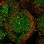 Immunofluorescent staining of human cell line A-431 shows localization to nucleoplasm, cytosol, microtubule organizing center & cell junctions.