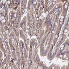 Anti-MRPL35 Antibody