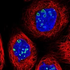 Immunofluorescent staining of human cell line A-431 shows localization to nucleoli.