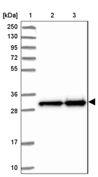 Lane 1: Marker [kDa] 250, 130, 95, 72, 55, 36, 28, 17, 10_br/_Lane 2: Human cell line RT-4_br/_Lane 3: Human cell line U-251MG sp