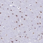 Immunohistochemical staining of human cerebral cortex shows moderate nuclear positivity in neurons.