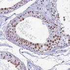 Immunohistochemical staining of human testis shows moderate nuclear positivity in cells in seminiferous ducts.