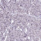 Anti-SRSF5 Antibody