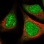 Immunofluorescent staining of human cell line U-2 OS shows localization to nucleus & nucleoli.