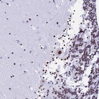 Anti-NSA2 Antibody