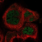 Immunofluorescent staining of human cell line A-431 shows localization to nucleoplasm.