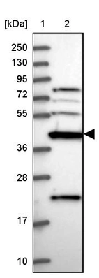 Lane 1: Marker [kDa] 250, 130, 95, 72, 55, 36, 28, 17, 10_br/_Lane 2: Human cell line RT-4