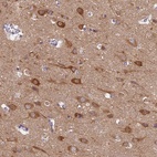 Anti-MRPS25 Antibody