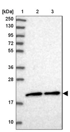 Lane 1: Marker [kDa] 250, 130, 95, 72, 55, 36, 28, 17, 10_br/_Lane 2: Human cell line RT-4_br/_Lane 3: Human cell line U-251MG sp