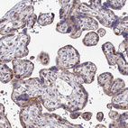 Immunohistochemical staining of human placenta shows moderate nuclear and weak cytoplasmic positivity in trophoblastic cells.