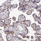Immunohistochemical staining of human placenta shows moderate nuclear and weak cytoplasmic positivity in trophoblastic cells.