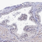 Immunohistochemical staining of human prostate shows moderate nuclear positivity in glandular cells.