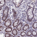 Immunohistochemical staining of human small intestine shows moderate nuclear positivity in glandular cells.