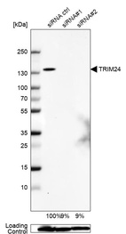 Western blot analysis in Caco-2 cells transfected with control siRNA, target specific siRNA probe #1 and #2, using Anti-TRIM24 antibody. Remaining relative intensity is presented. Loading control: Anti-GAPDH.