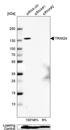 Western blot analysis in Caco-2 cells transfected with control siRNA, target specific siRNA probe #1 and #2, using Anti-TRIM24 antibody. Remaining relative intensity is presented. Loading control: Anti-GAPDH.
