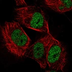 Immunofluorescent staining of human cell line U-251 MG shows localization to nucleoplasm.