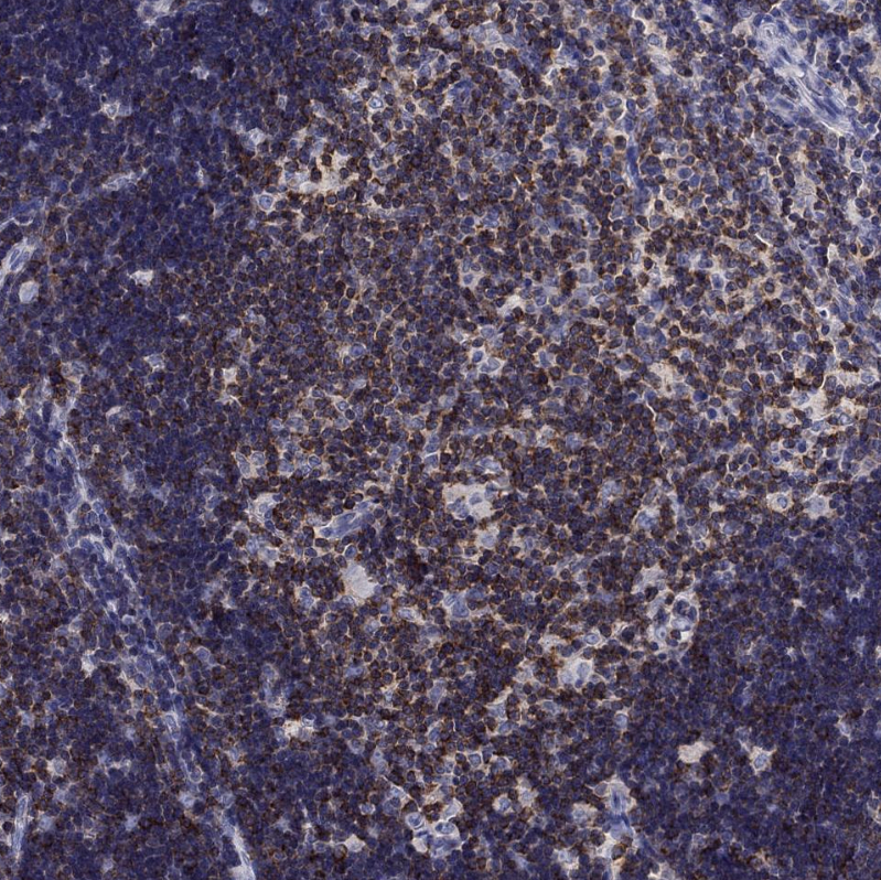 Anti-MND1 Antibody