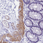 Anti-FBXW4 Antibody