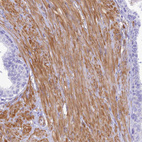 Immunohistochemical staining of human prostate shows strong cytoplasmic positivity in smooth muscle cells.