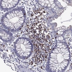 Immunohistochemical staining of human rectum shows strong nuclear positivity in lymphoid cells.