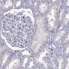 Immunohistochemical staining of human kidney shows no nuclear positivity in cells in tubules as expected.
