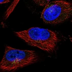 Immunofluorescent staining of human cell line U-251 MG shows localization to the Golgi apparatus.