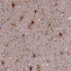 Anti-ELOA2 Antibody