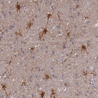 Anti-ELOA2 Antibody