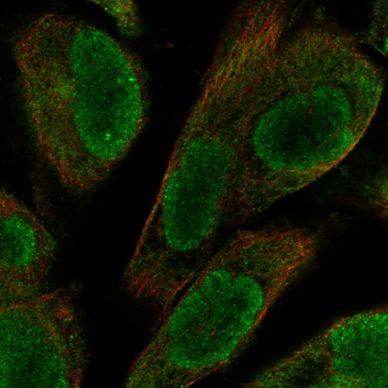 Anti-UACA Antibody